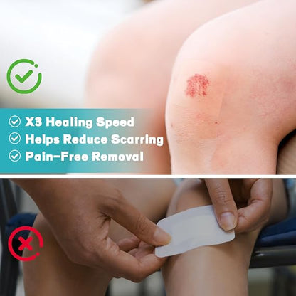 Hydrocolloid Wound Care Bandage Roll