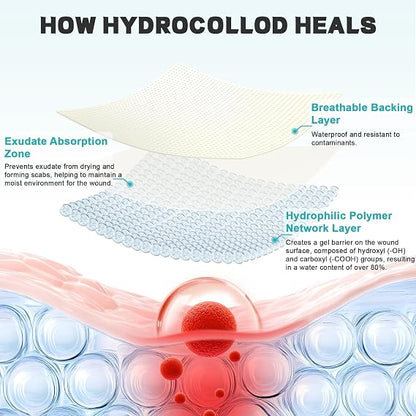 Hydrocolloid Wound Care Bandage Roll