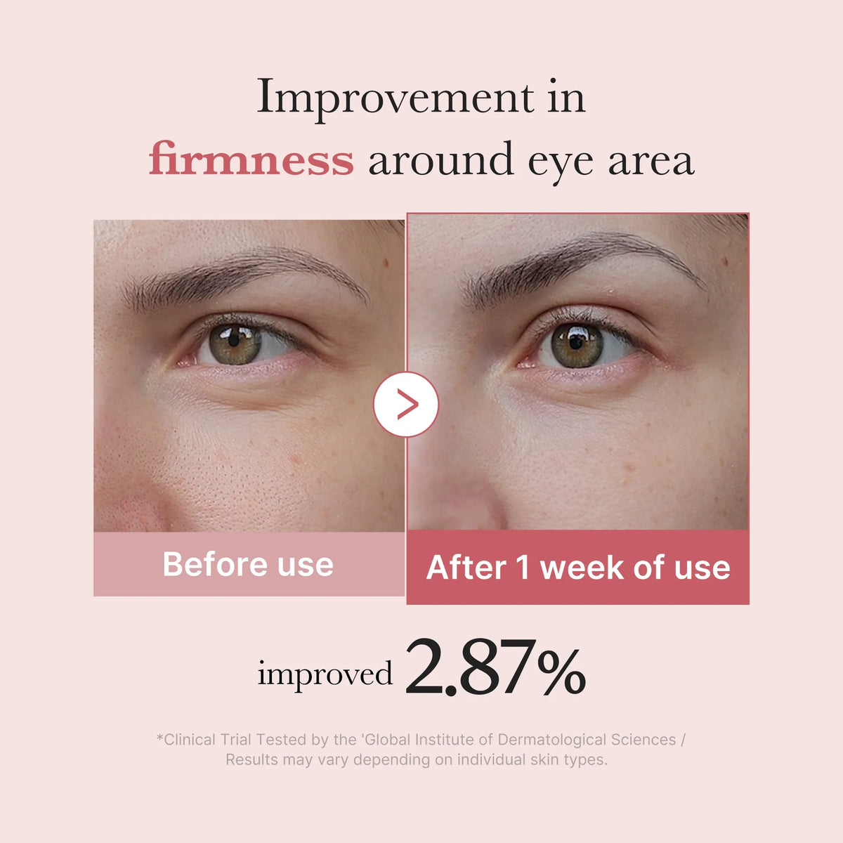 Medicube PDRN Pink Peptide Eye Cream