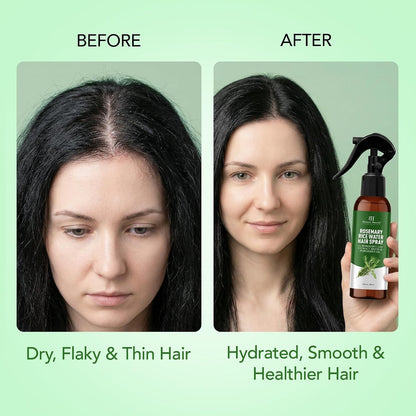 Botanic Hearth Rosemary and Rice Water Spray For Hair Growth
